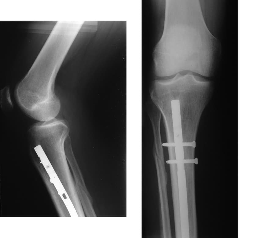 File:K-Knie-z2.jpg - Wikipedia