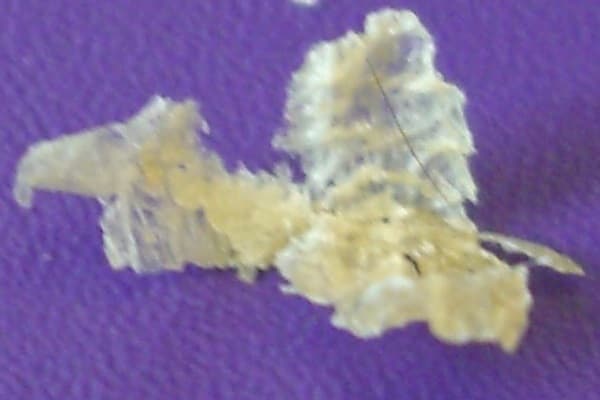 ABCC11 – Wikipedia